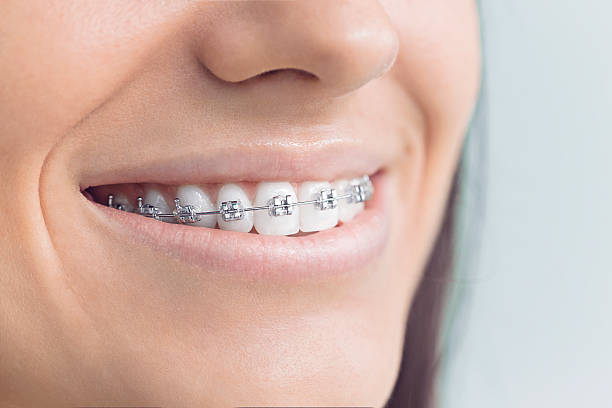 Best Teeth Whitening  in Keedysville, MD